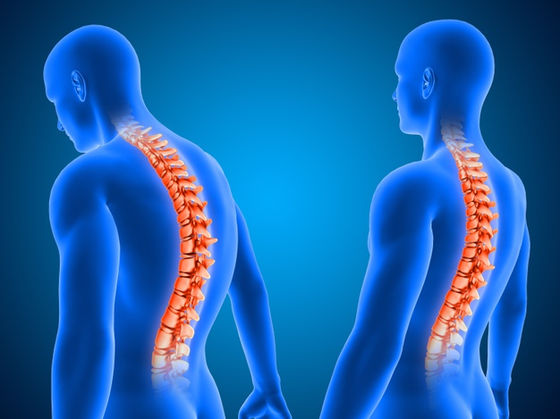 Four Simple Ways to Help You Develop Your Posture - Center for Spine and  Ortho