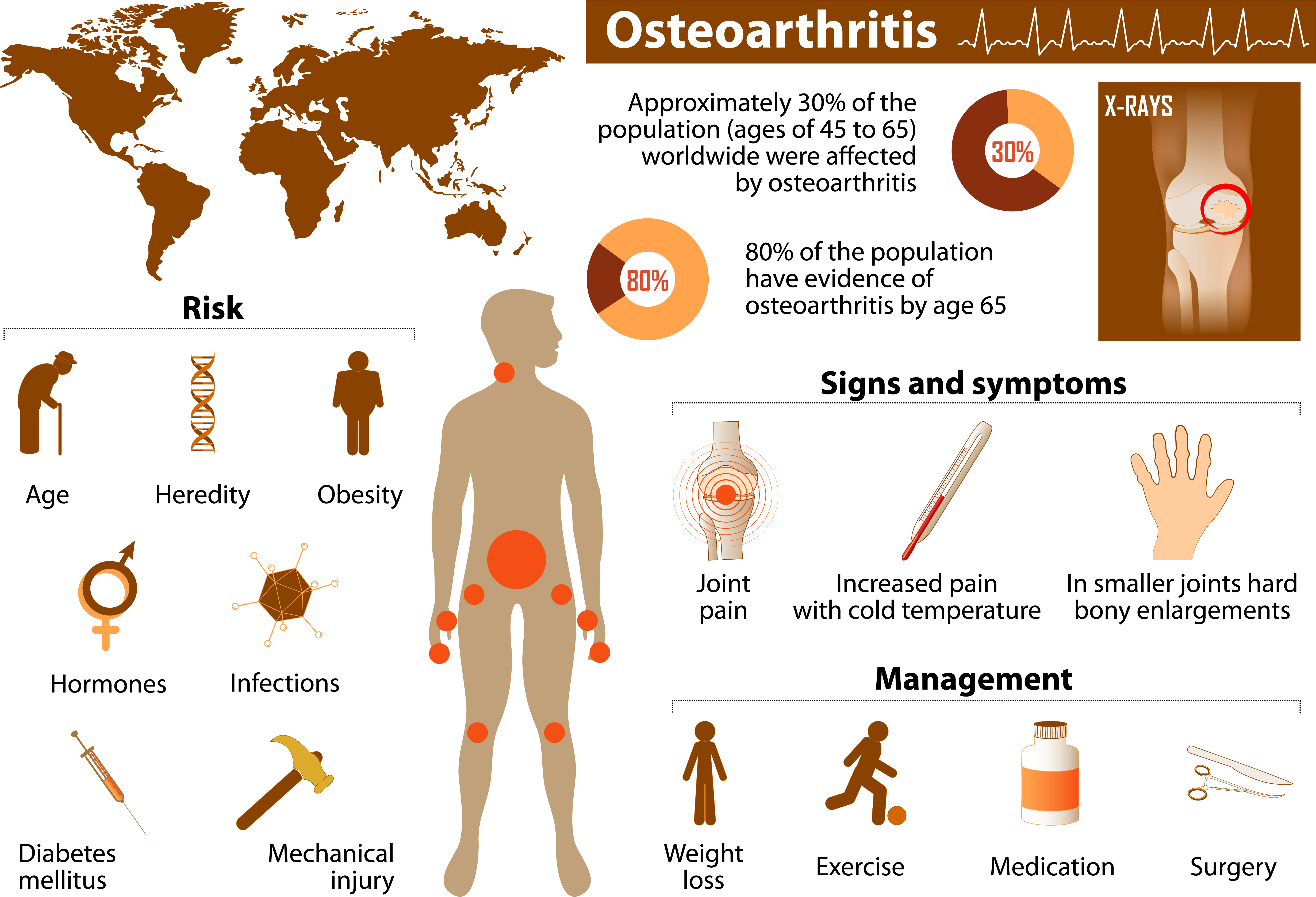 osteoarthiritis