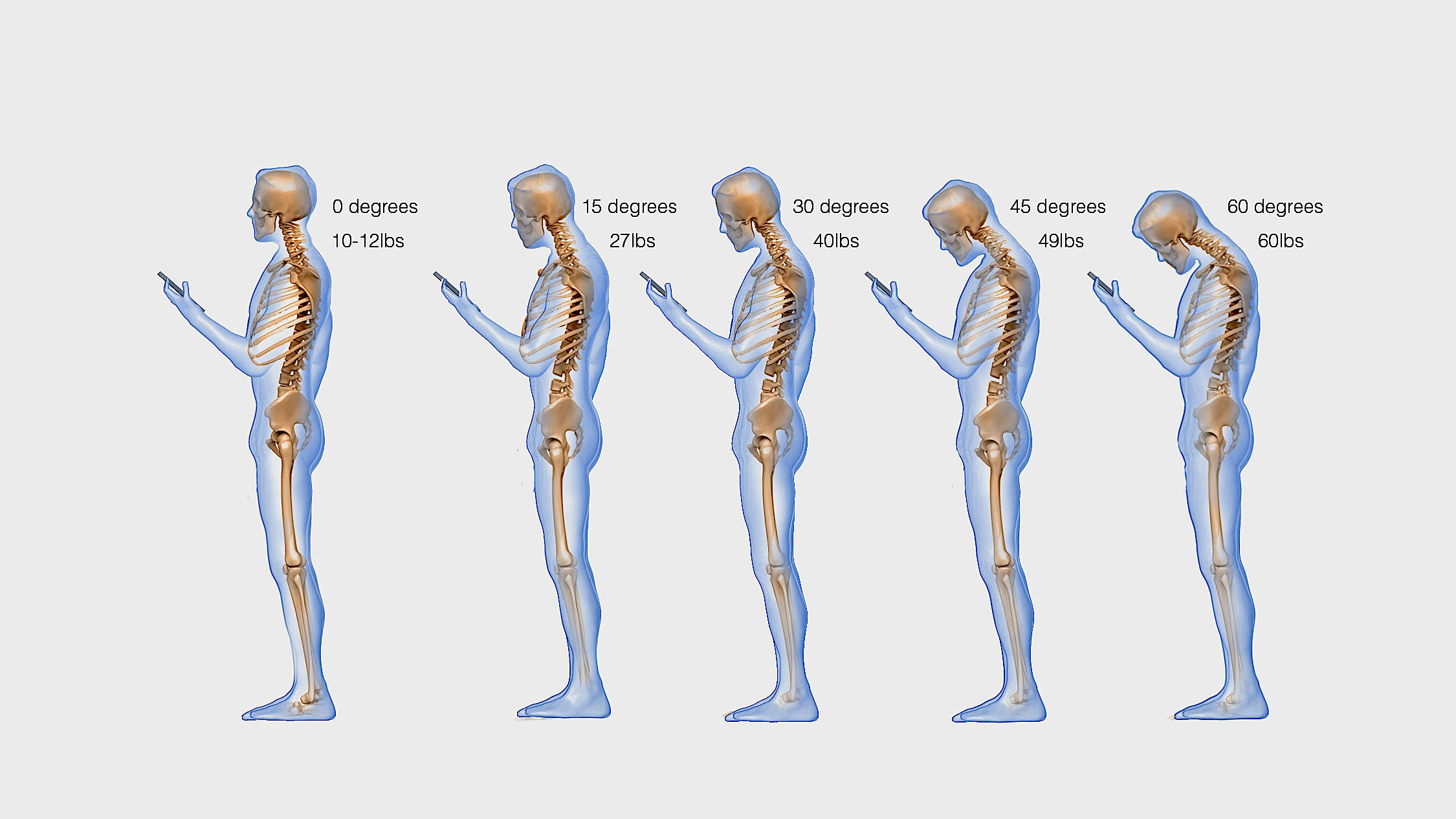Posture and stress on the cervical spine.