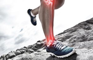 RUNNING INJURIES