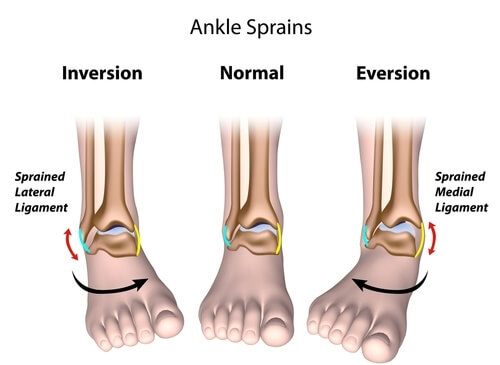 ankle-injury